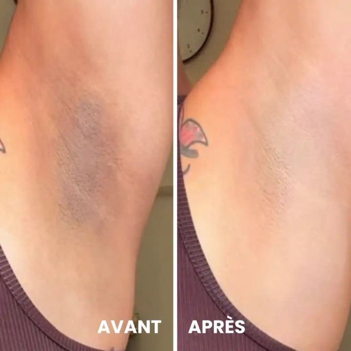 Verhelderende exfoliërende spray